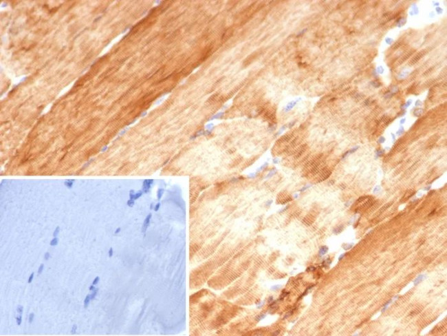 Crystallin Alpha B Antibody in Immunohistochemistry (Paraffin) (IHC (P))