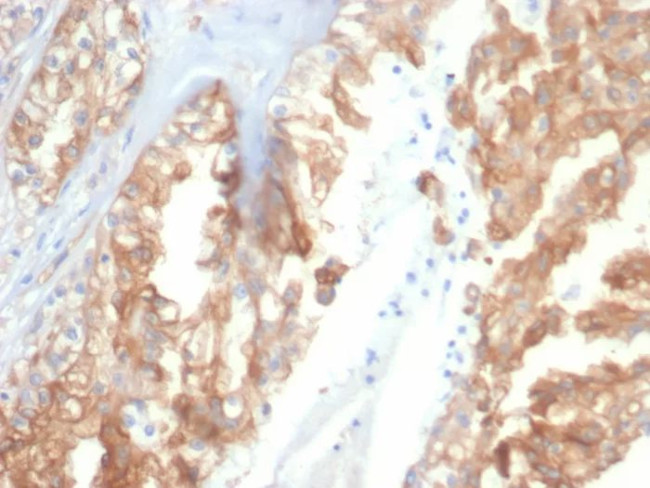 Crystallin Alpha B Antibody in Immunohistochemistry (Paraffin) (IHC (P))