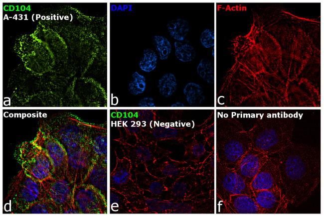 CD104 (Integrin beta 4) Antibody in Immunocytochemistry (ICC/IF)