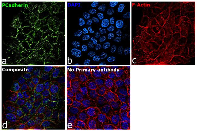 P-Cadherin Antibody in Immunocytochemistry (ICC/IF)