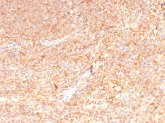 GM-CSF (Granulocyte/Macrophage - Colony Stimulating Factor) Antibody in Immunohistochemistry (Paraffin) (IHC (P))