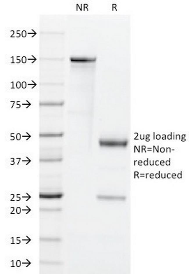 GM-CSF (Granulocyte/Macrophage - Colony Stimulating Factor) Antibody in SDS-PAGE (SDS-PAGE)