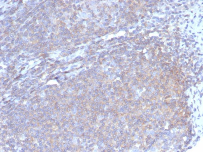 Granulocyte-Colony Stimulating Factor (G-CSF) Antibody in Immunohistochemistry (Paraffin) (IHC (P))