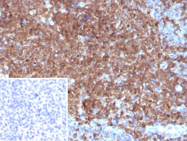 Granulocyte-Colony Stimulating Factor (G-CSF) Antibody in Immunohistochemistry (Paraffin) (IHC (P))