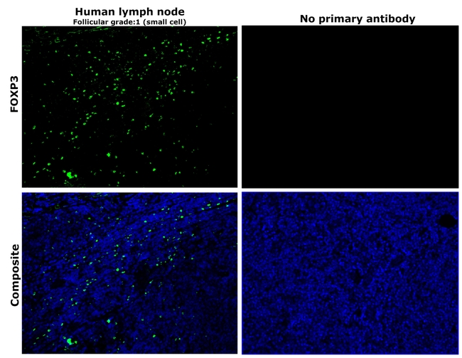 FOXP3 Antibody in Immunohistochemistry (Paraffin) (IHC (P))