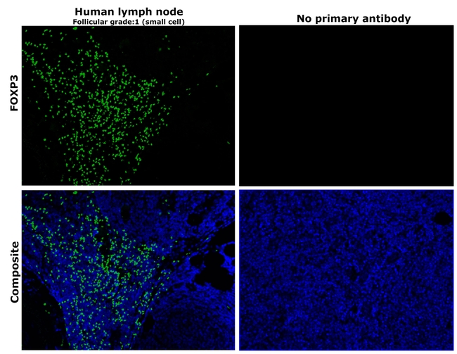 FOXP3 Antibody in Immunohistochemistry (Paraffin) (IHC (P))