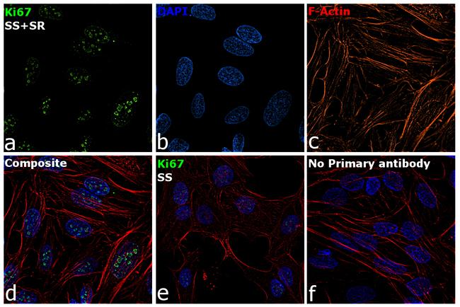 Ki-67 Antibody in Immunocytochemistry (ICC/IF)