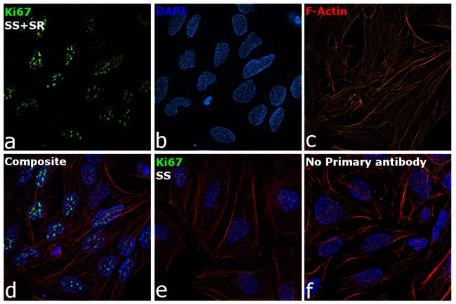 Ki-67 Antibody in Immunocytochemistry (ICC/IF)