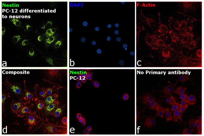 Nestin Antibody in Immunocytochemistry (ICC/IF)