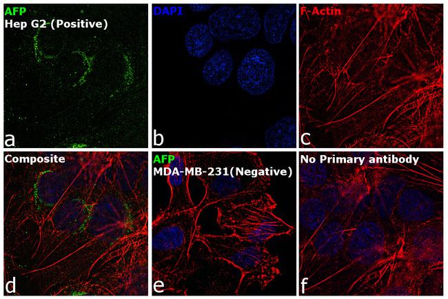 alpha-Fetoprotein Antibody in Immunocytochemistry (ICC/IF)