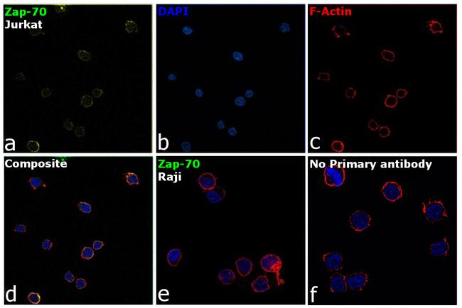 Zap-70 Antibody in Immunocytochemistry (ICC/IF)