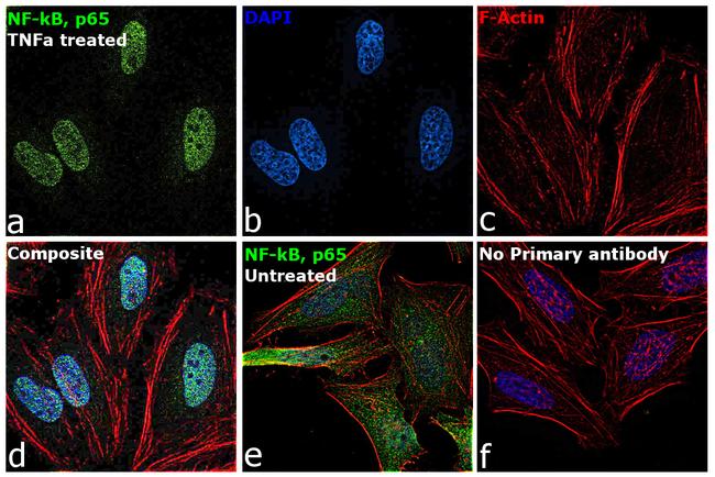 NFkB p65 Antibody in Immunocytochemistry (ICC/IF)