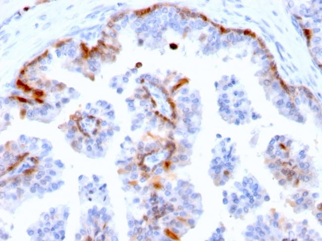 Cystatin A Antibody in Immunohistochemistry (Paraffin) (IHC (P))