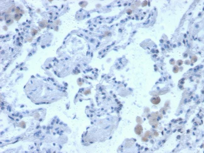 Cystatin B Antibody in Immunohistochemistry (Paraffin) (IHC (P))