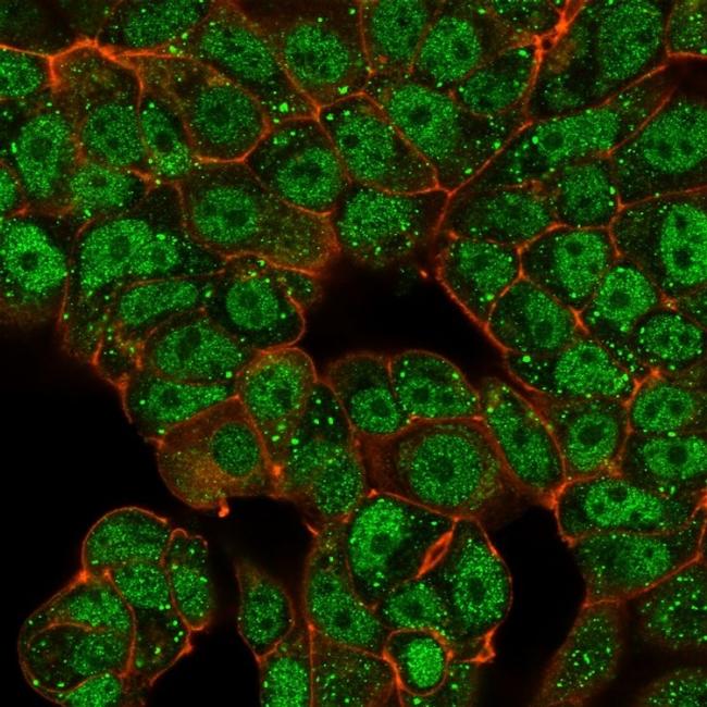 CTBP2 (C-terminal binding protein 2) Antibody in Immunocytochemistry (ICC/IF)