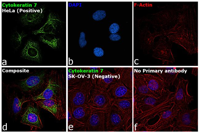 Cytokeratin 7 Antibody in Immunocytochemistry (ICC/IF)