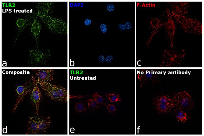 CD282 (TLR2) Antibody in Immunocytochemistry (ICC/IF)