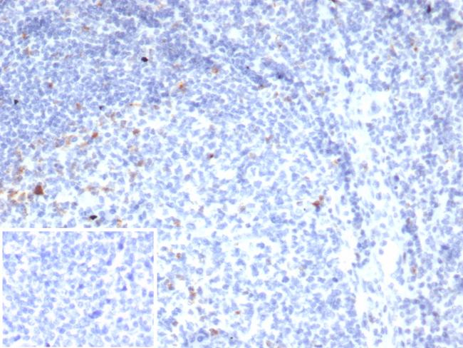 CTLA4/CD152 (Negative Regulator of T-Cells) Antibody in Immunohistochemistry (Paraffin) (IHC (P))