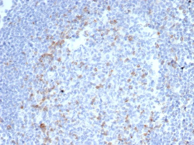 CTLA4/CD152 (Negative Regulator of T-Cells) Antibody in Immunohistochemistry (Paraffin) (IHC (P))