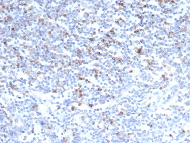 CTLA4/CD152 (Negative Regulator of T-Cells) Antibody in Immunohistochemistry (Paraffin) (IHC (P))