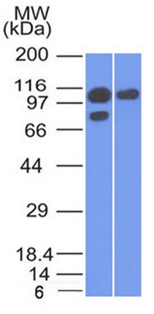 Catenin, alpha-1 (CTNNA1) Antibody in Western Blot (WB)