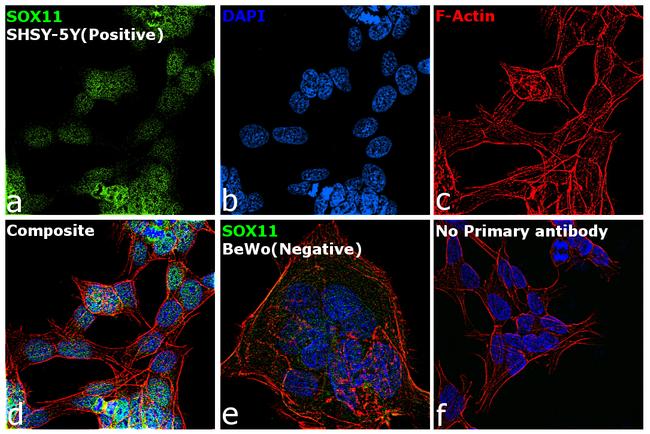 SOX11 Antibody in Immunocytochemistry (ICC/IF)