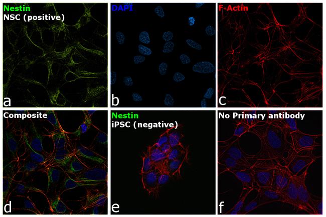 Nestin Antibody in Immunocytochemistry (ICC/IF)