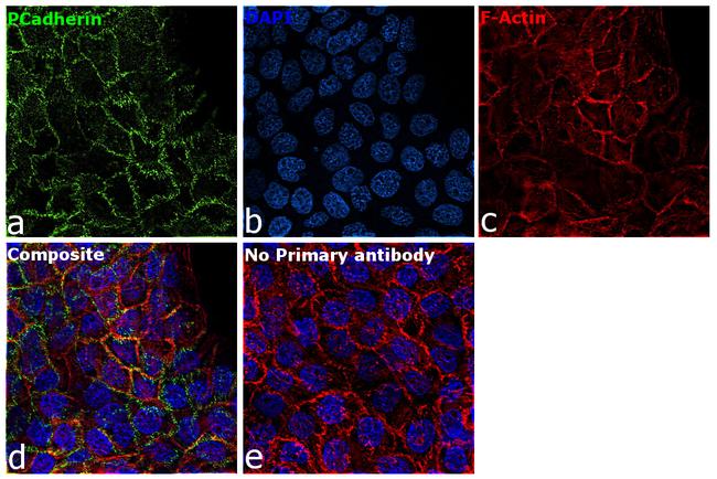 P-cadherin Antibody in Immunocytochemistry (ICC/IF)