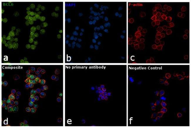 BCL6 Antibody in Immunocytochemistry (ICC/IF)