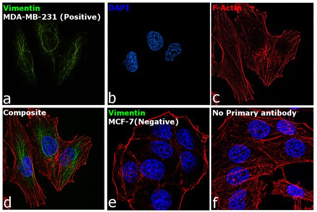 Vimentin Antibody in Immunocytochemistry (ICC/IF)