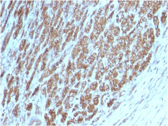 Catenin, beta (p120) Antibody in Immunohistochemistry (Paraffin) (IHC (P))