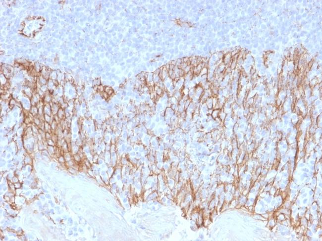 Catenin, beta (p120) Antibody in Immunohistochemistry (Paraffin) (IHC (P))