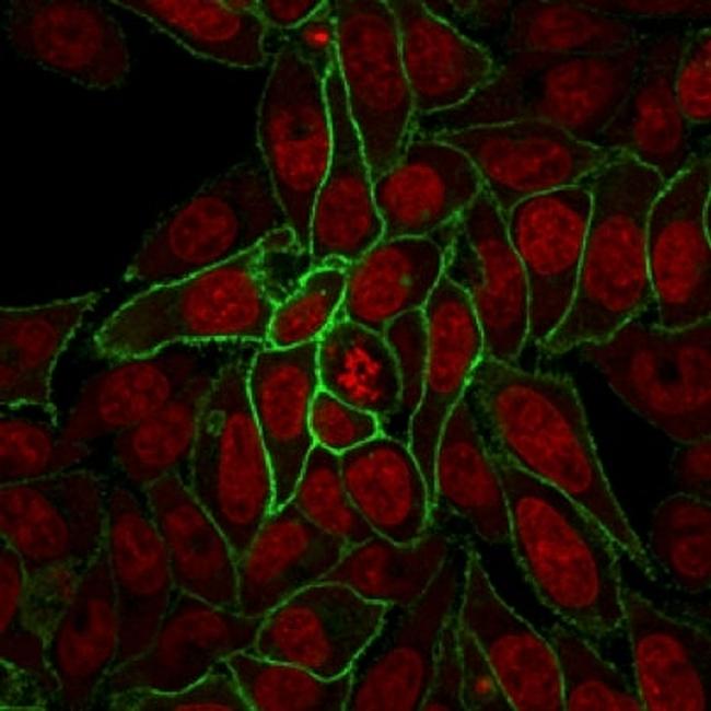 Catenin, beta (p120) Antibody in Immunocytochemistry (ICC/IF)