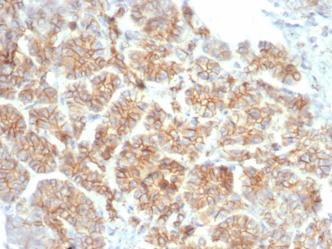 Catenin, beta (CTNNB1) Antibody in Immunohistochemistry (Paraffin) (IHC (P))