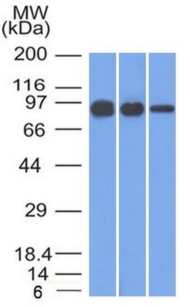 Catenin, beta (p120) Antibody in Western Blot (WB)