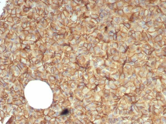 Catenin, beta (CTNNB1) Antibody in Immunohistochemistry (Paraffin) (IHC (P))