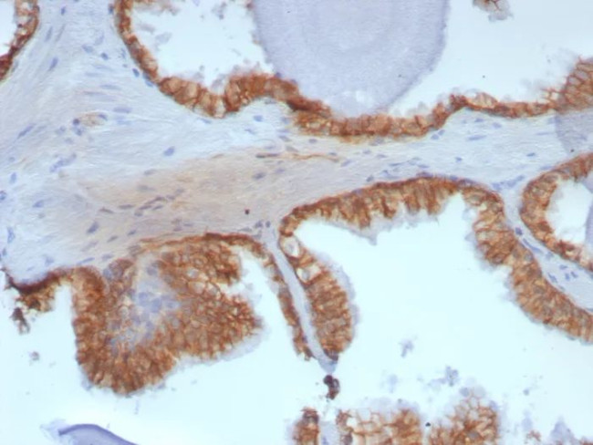 Catenin, beta (CTNNB1) Antibody in Immunohistochemistry (Paraffin) (IHC (P))