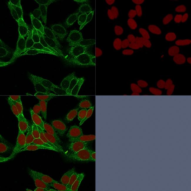 Catenin, beta (p120) Antibody in Immunocytochemistry (ICC/IF)