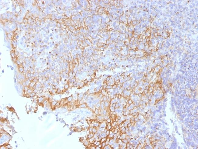 Catenin, beta (p120) Antibody in Immunohistochemistry (Paraffin) (IHC (P))