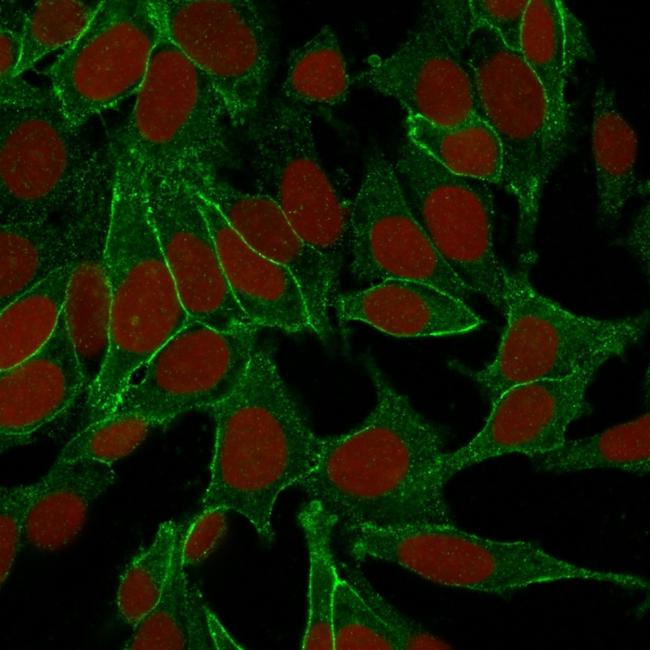 Catenin, beta (p120) Antibody in Immunocytochemistry (ICC/IF)