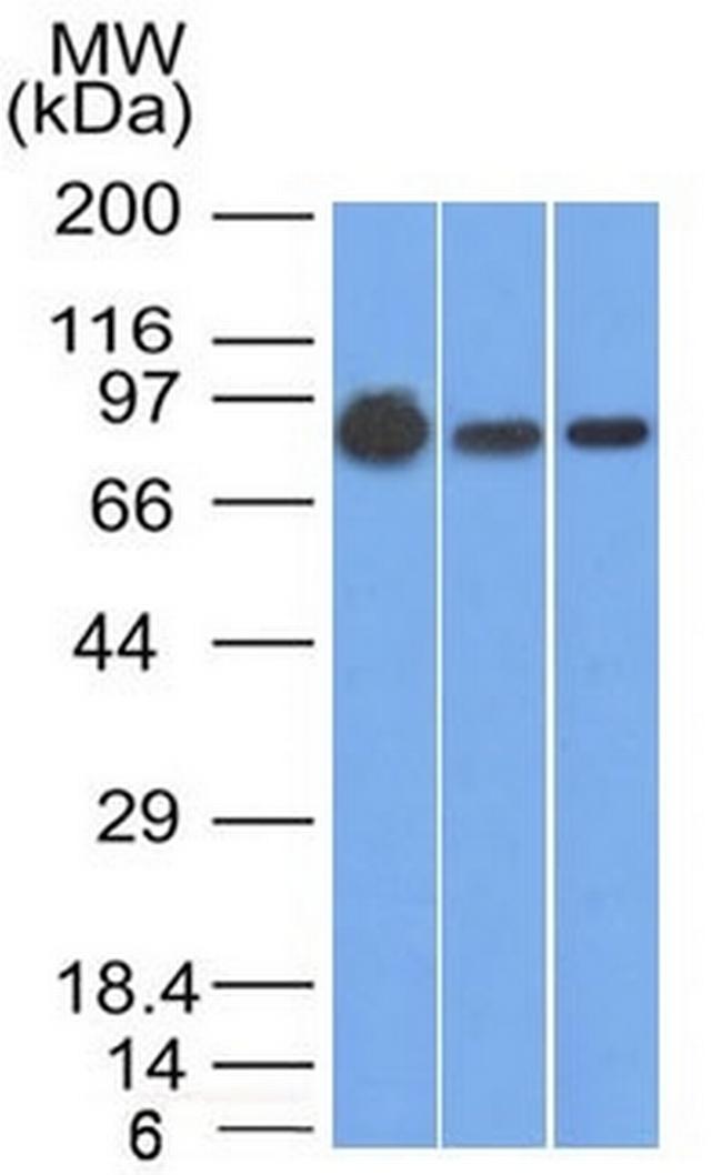 Catenin, beta (p120) Antibody in Western Blot (WB)