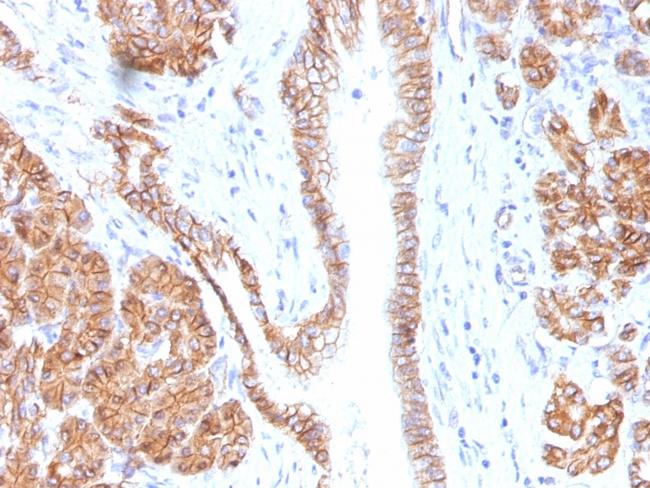 Catenin, beta (p120) Antibody in Immunohistochemistry (Paraffin) (IHC (P))