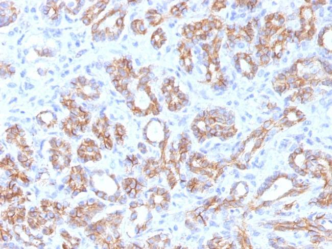 Catenin, beta (p120) Antibody in Immunohistochemistry (Paraffin) (IHC (P))