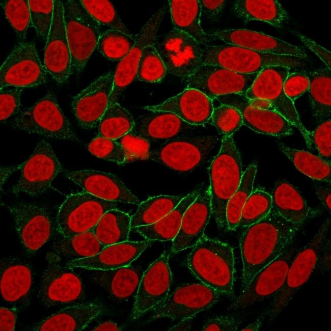 Catenin, beta (p120) Antibody in Immunocytochemistry (ICC/IF)