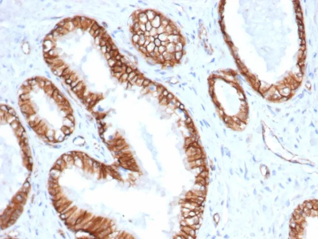 Catenin, beta (CTNNB1) Antibody in Immunohistochemistry (Paraffin) (IHC (P))