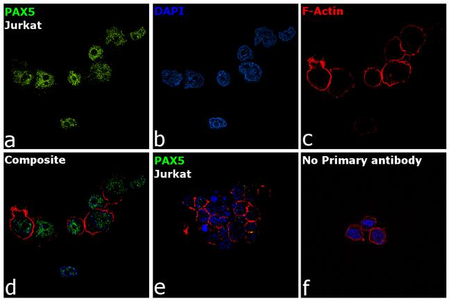 PAX5 Antibody in Immunocytochemistry (ICC/IF)