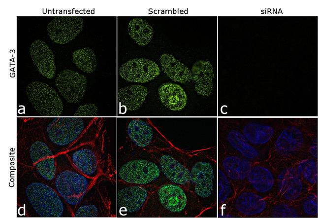 Gata-3 Antibody in Immunocytochemistry (ICC/IF)