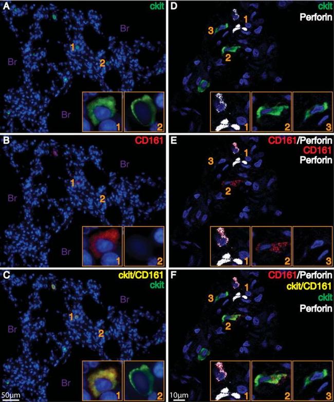 Perforin Antibody in Immunohistochemistry (IHC)