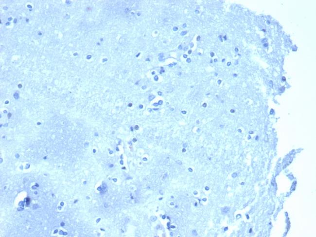 p120/Catenin, delta-1 (CTNND1) Antibody in Immunohistochemistry (Paraffin) (IHC (P))