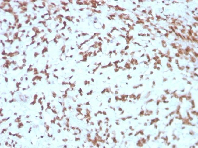 Cathepsin D Antibody in Immunohistochemistry (Paraffin) (IHC (P))